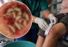 SLP suma cinco casos de miasis por gusano barrenador